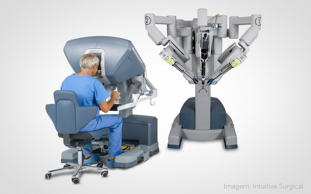 Onconews - Estudo inglês põe em xeque superioridade da prostatectomia  robótica